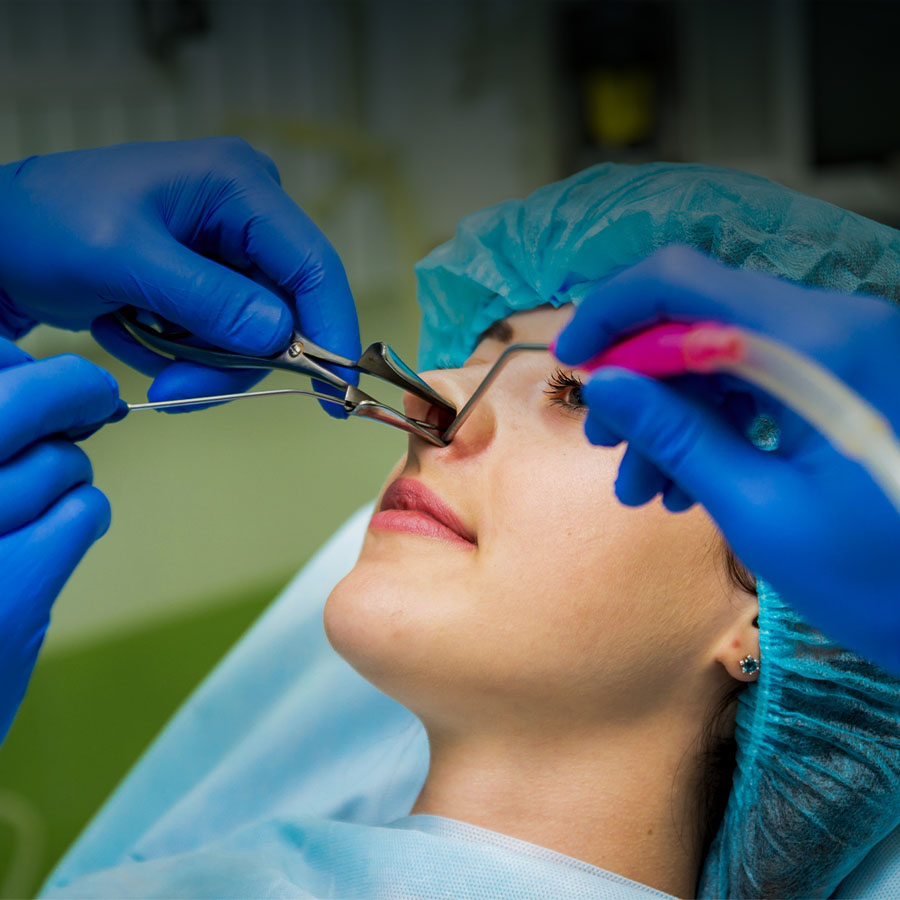 Breathing Better: When Nasal Surgery May Help